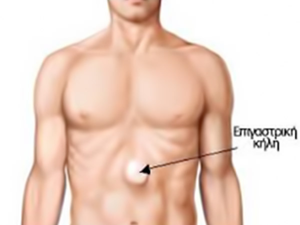 epigastriki-kili