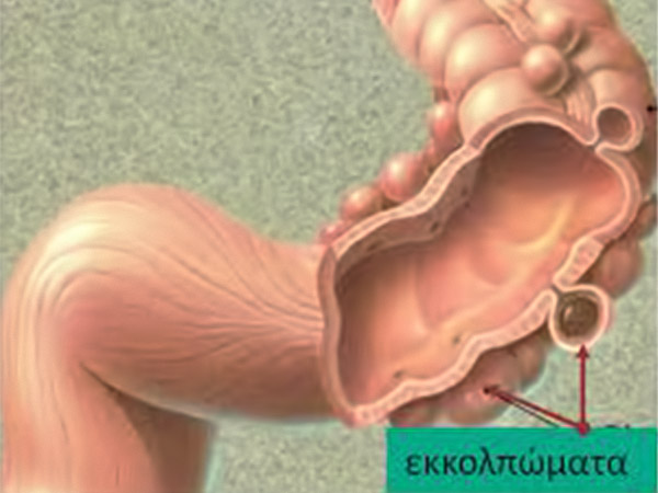 ekkolpomata